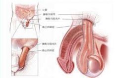 精囊炎的原因有哪些呢