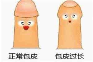 包皮过长是种什么样的现象